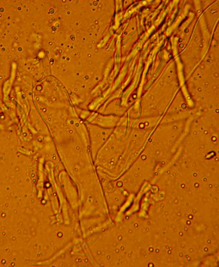 Aleurodiscus amorphus (Fr.)Schroeter